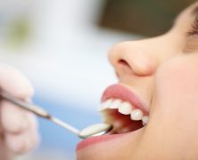 General Dentistry In Lockport Will Keep Your Smile Healthy