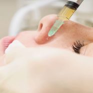 Reveal Clearer Skin Fast with a Chemical Peel In Fayetteville Skincare Solution